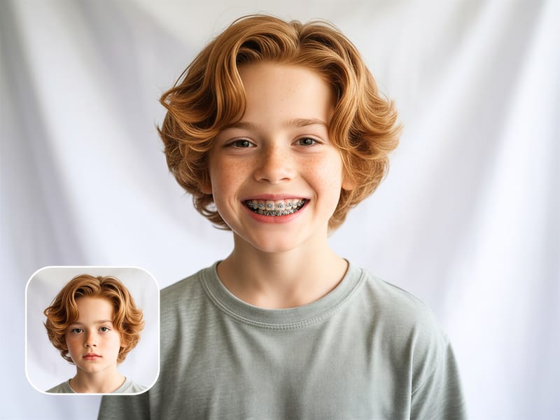 牙套濾鏡 Cover Image