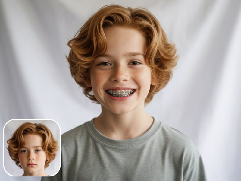 Lisää hammasraudat